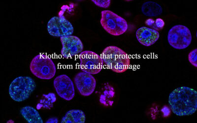 Klotho: A protein that protects cells from free radical damage